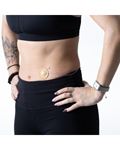 Capteur Protect Unterklebepflaster kompatibel für Orbit Katheter